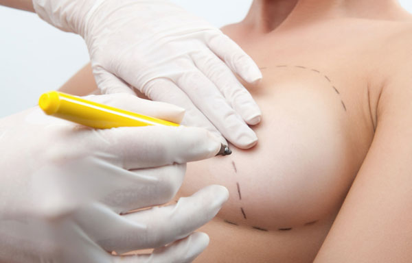 Malformations du thorax et/ou du sein